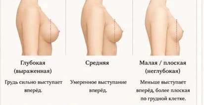 Проекция груди: глубокая, средняя, малая плоская